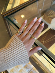 Embedded Signet Ring